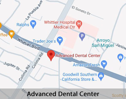 Map image for Dental Veneers and Dental Laminates in Whittier, CA